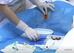 尿道感染视频,视频解析病因、症状及防治方法